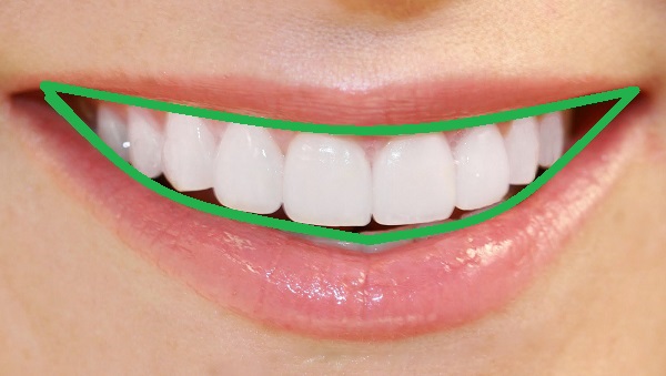 dientes-perfectos-alineados