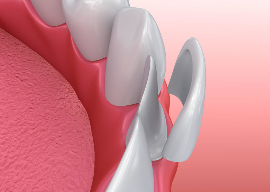 dental-zubident